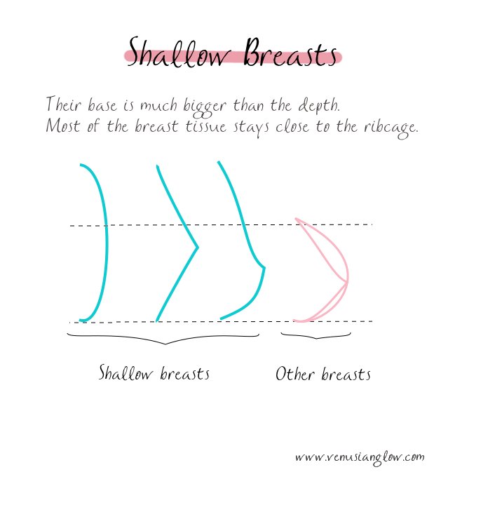 shallow breasts