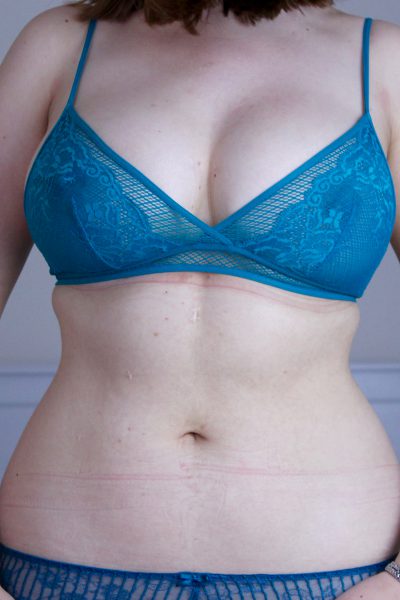 H&M Triangle lace bra